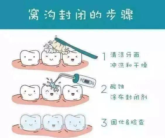 看牙貴？一定要抓住這7次省錢的機(jī)會(huì)！
