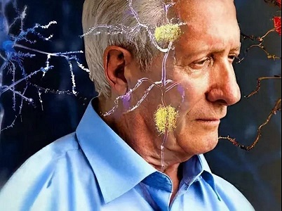 老年癡呆與口腔：潔牙能預(yù)防老年癡呆，真的嗎？