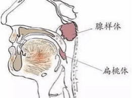 矯正牙齒前竟然要先看耳鼻喉科？ 