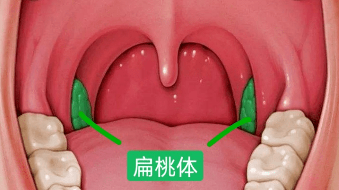 矯正牙齒前竟然要先看耳鼻喉科？ 