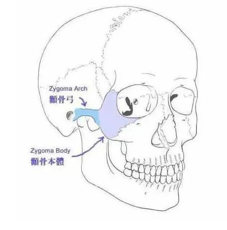 正畸如何預(yù)防牙套臉及法令紋