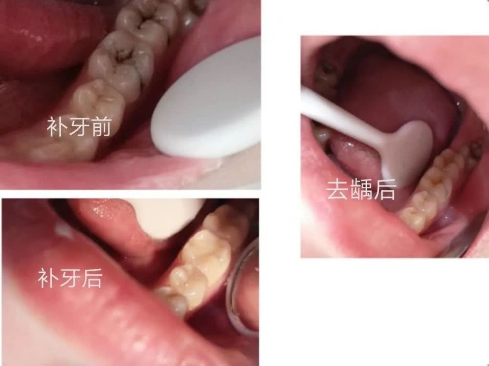 口腔常見小問題和自我處理方法！