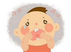 寶寶嘴里長紅泡 可別把口腔炎當(dāng)成手口病