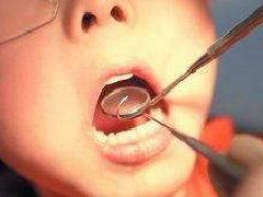 小孩子什么時(shí)候拔乳牙最好，那些情況需要拔乳牙？