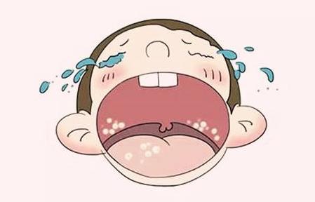 一歲半寶寶口腔潰瘍?cè)趺崔k