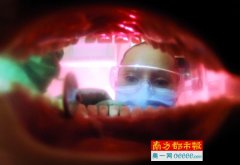 口腔長白斑，小心癌前病變