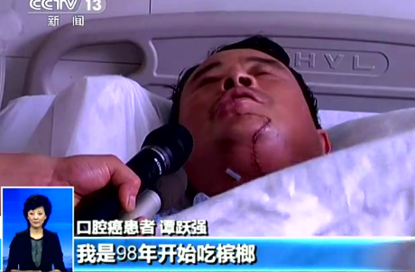吸煙、喝酒、嚼檳榔？小心這種癌癥找上門